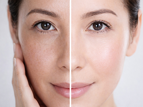 くすみ・疲れ肌